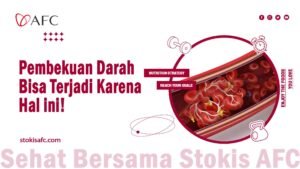 Read more about the article Pembekuan Darah Bisa Terjadi Karena Hal ini!